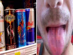 不要喝太多！　男子每天灌6瓶能量飲　口腔痛檢查出「舌頭被腐蝕」
