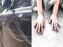 女兒調皮刮花爸爸的愛車，爸爸一氣之下竟害她失去雙手，多年後女兒的天真無邪的話讓爸爸崩潰舉槍自殺！