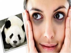 擺脫不掉的熊貓眼  黑眼圈急救法有哪些？